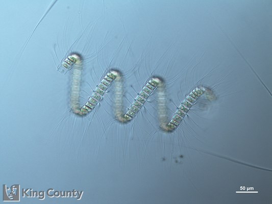 Photo of Chaetoceros debilis